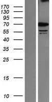 SRPR Protein (Over-Expression Lysate Myc-DDK (Flag))
