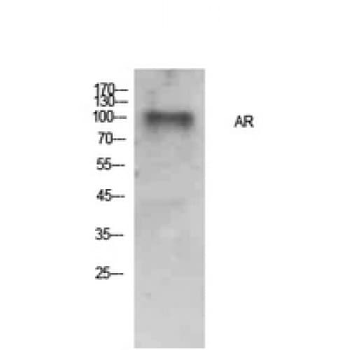AR / Androgen Receptor Antibody (Internal)