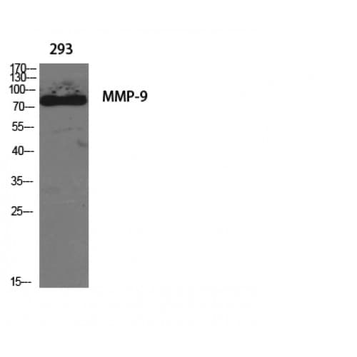 MMP9 / Gelatinase B Antibody (620-700 aa, C-terminal)