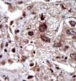 STK39 / SPAK Antibody (aa346-376)