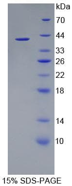 Human PDE1A Protein (Recombinant His-T7)