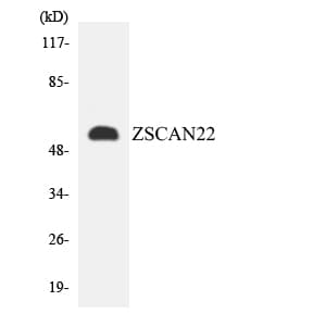 Polyclonal Rabbit anti-Human ZSCAN22 Antibody (aa304-353, IHC, WB)