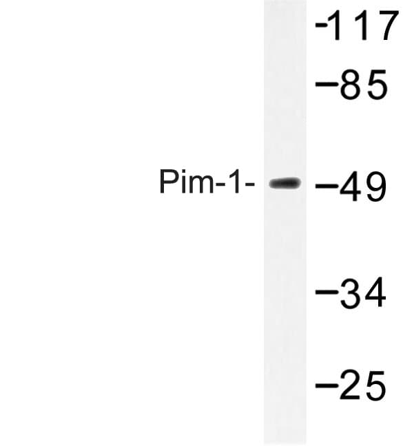 Polyclonal Rabbit anti-Human PIM1 / Pim-1 Antibody (Ile302, WB)