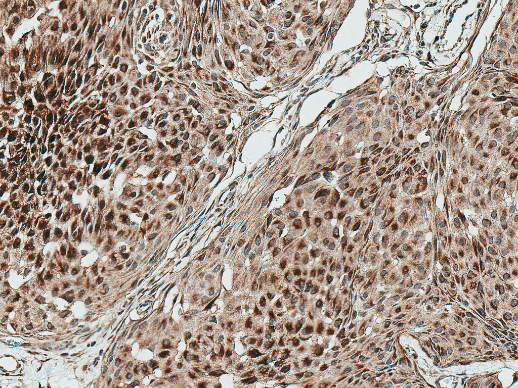 HSF2 Antibody (Atto 594)