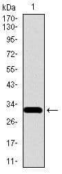 SLC27A5 / BACS Antibody (Amino Acid: 508-570, clone 4B11C10)
