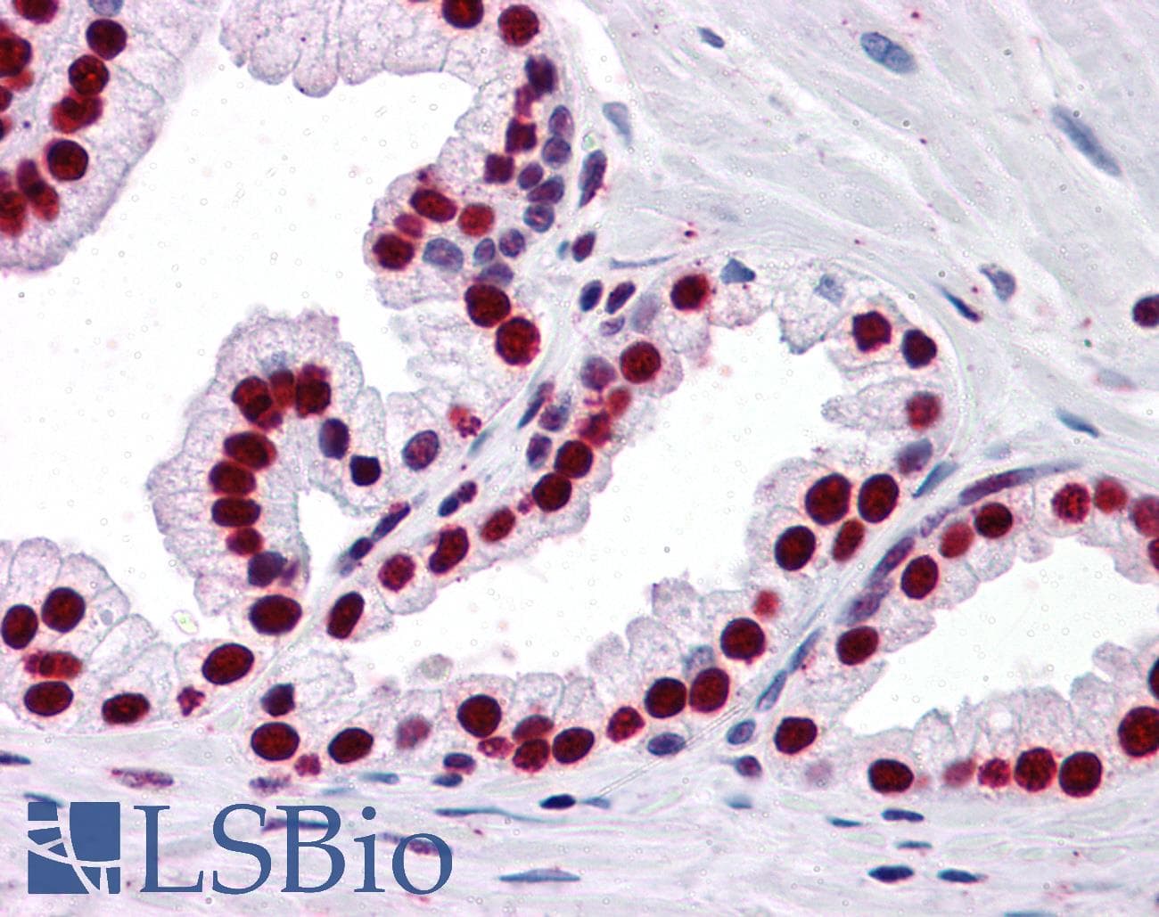 IHC-plus™ Monoclonal Mouse anti-Human SMAD6 Antibody (clone 4C8, IHC, WB)