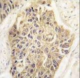 MAGEA1 / MAGE 1 Antibody (aa143-173)