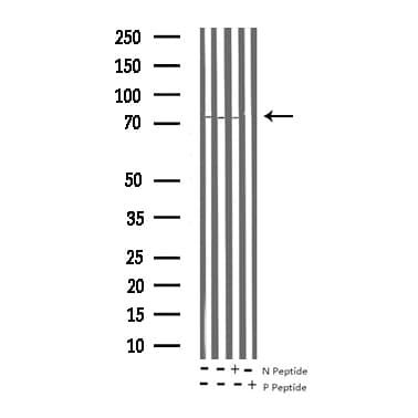 p66 / SHC Antibody (phospho-Tyr349)