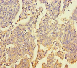 ZNF662 Antibody