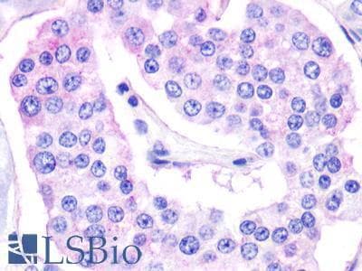 PathPlus™ GPR119 Antibody (Cytoplasmic Domain)
