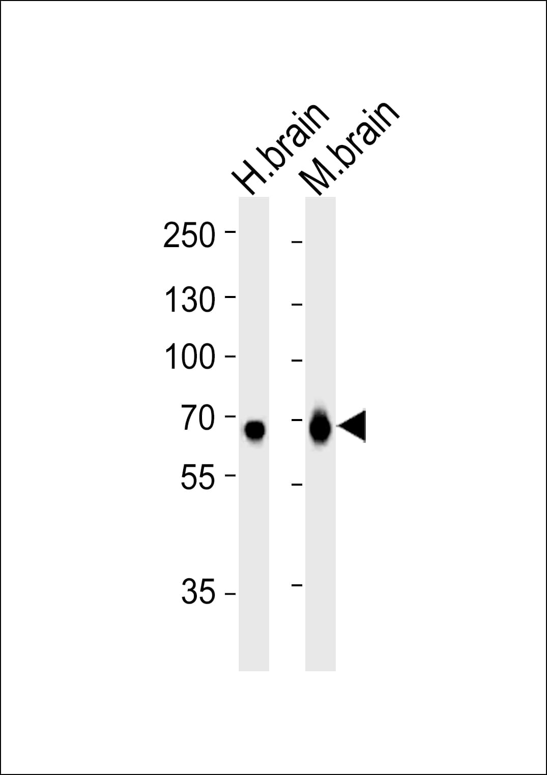 GLS / Glutaminase Antibody (aa516-545)