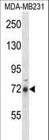 IHC-plus™ RIPK1 / RIP Antibody (aa152-180)