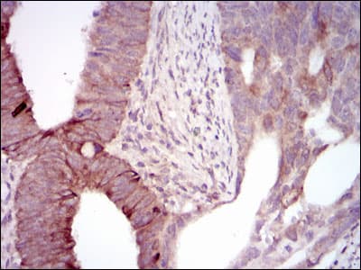MELK Antibody (clone 2G2)