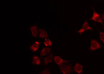 Polyclonal Rabbit anti-Human GCNT7 Antibody (IHC, IF, WB)