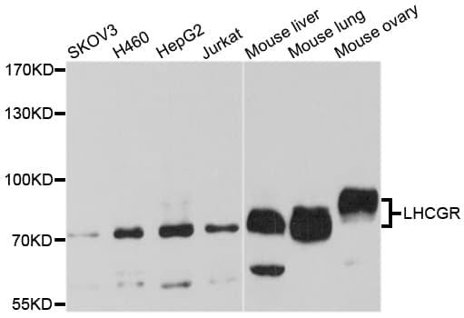 Polyclonal Rabbit anti-Human LHCGR / LHR / LH Receptor Antibody (WB)