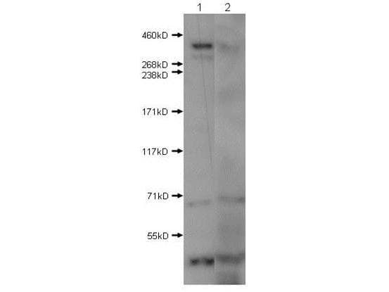 HTT / Huntingtin Antibody (N-Terminus)