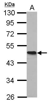 IHC-plus™ HOMER1 / Homer 1 Antibody (aa72-339)