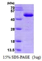 Human GSTP1 / GST Pi Protein (Recombinant His)
