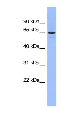 SLC34A3 / NaPi-2c Antibody (aa215-264)