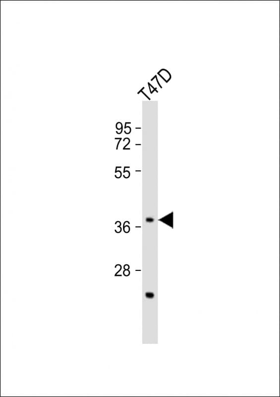 CTSV / Cathepsin V Antibody (aa94-129)