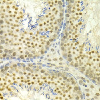 Polyclonal Rabbit anti-Human MAPK3 / ERK1 Antibody (IHC, IF, WB)