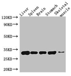 GPM6A / Glycoprotein M6A Antibody