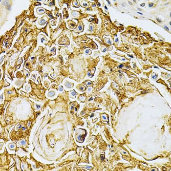 ADRBK1 / GRK2 Antibody