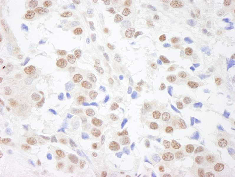 IHC-plus™ SAFB1 / SAFB Antibody (aa775-825)