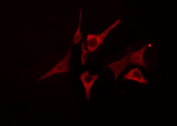 LIPC / Hepatic Lipase Antibody