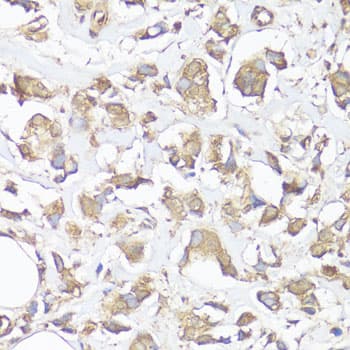 VTN / Vitronectin Antibody