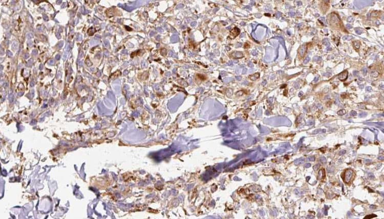 Polyclonal Rabbit anti-Human APCS / Serum Amyloid P / SAP Antibody (IHC, WB)