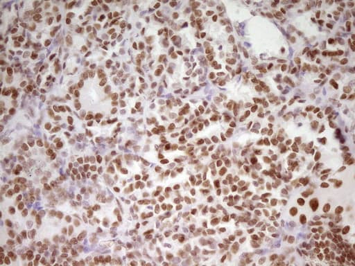 Monoclonal Mouse anti-Human HMG20A Antibody (clone OTI2H4, Carrier-free, aa1-281, IHC, WB)