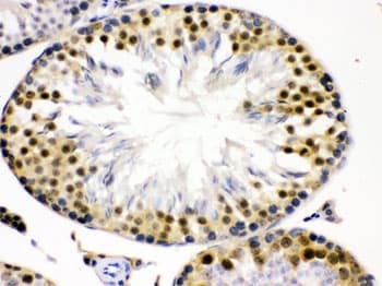 Polyclonal Rabbit anti-Human CDK2 Antibody (IHC, WB)