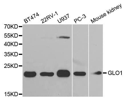 Polyclonal Rabbit anti-Human GLO1 / Glyoxalase I Antibody (IHC, IF, WB)