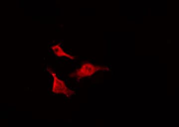 CDC25B Antibody (phospho-Ser323)