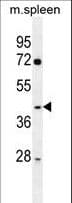 IHC-plus™ NFKBID / IkappaBNS Antibody (aa91-119)