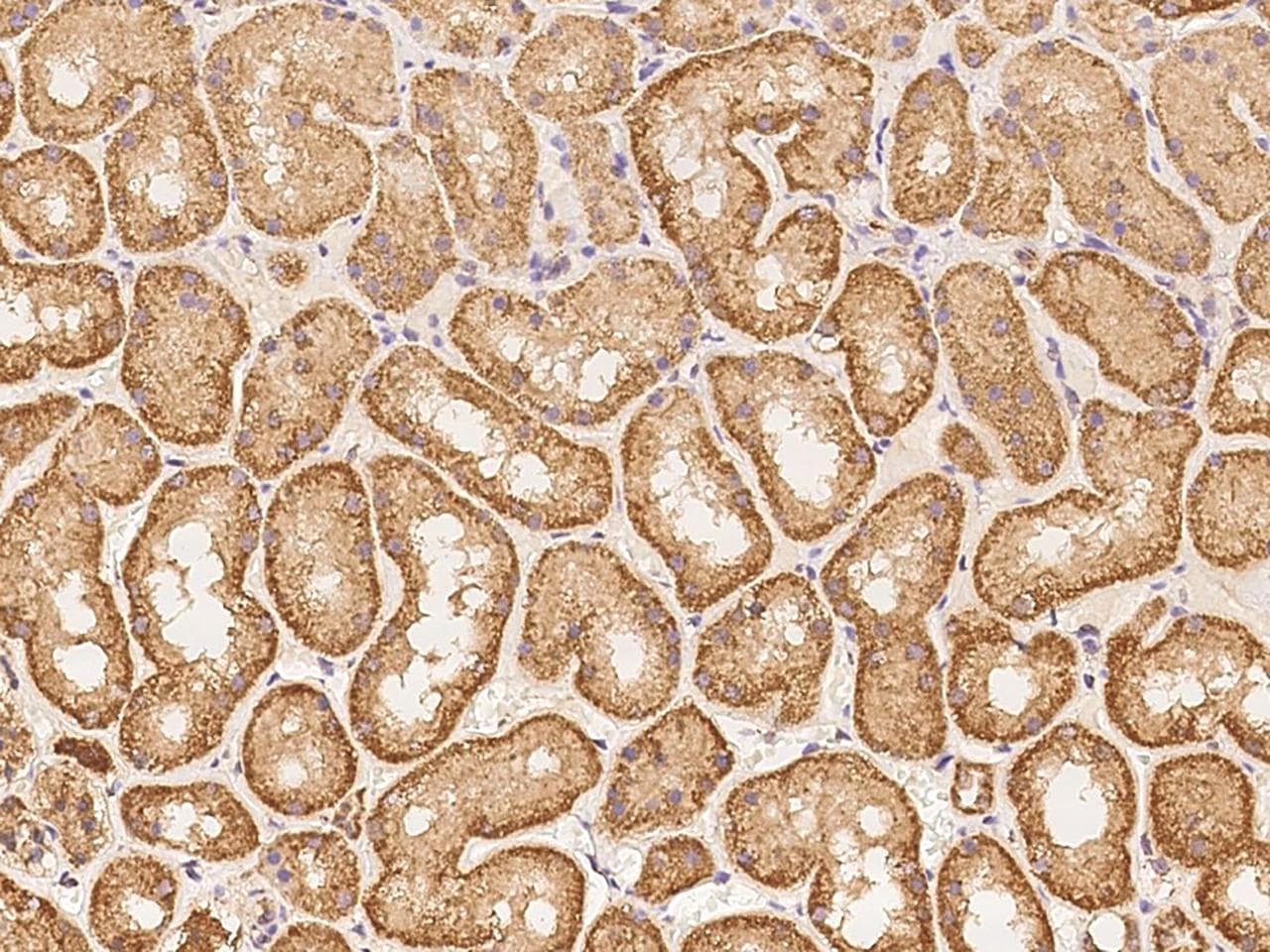 ACTR3C Antibody