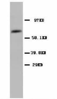 PTGS1 / COX-1 Antibody (N-Terminus, Sepharose)