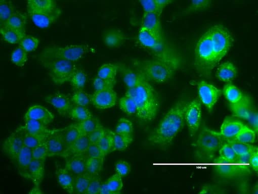 ERBB2 / HER2 Antibody (aa676-1255, clone UMAB33, Carrier-free)