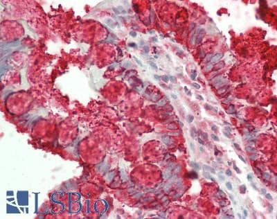 Polyclonal Rabbit anti-Human TFF3 / Trefoil Factor 3 Antibody (aa22-94, IHC, WB)
