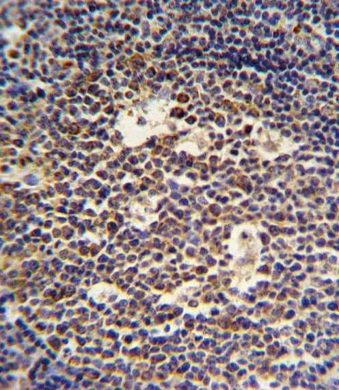 Polyclonal Rabbit anti-Human IL4 Antibody (aa122-150, IHC, WB)