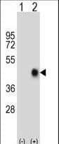 CD95 / FAS Antibody (aa185-211)