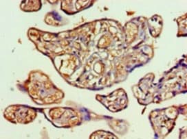 Polyclonal Rabbit anti-Human Transaldolase Antibody (IHC, WB)