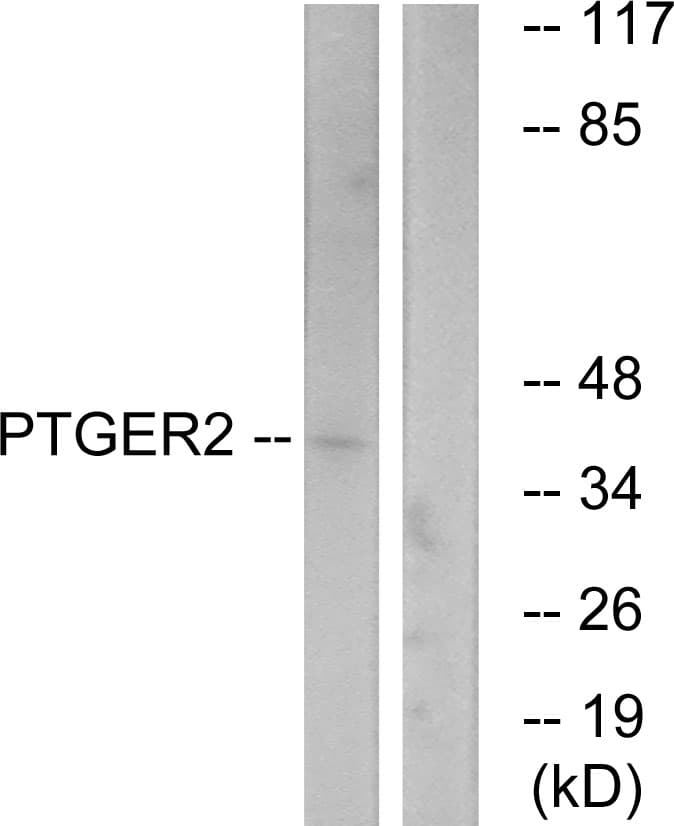 PTGER2 / EP2 Antibody (aa260-309)