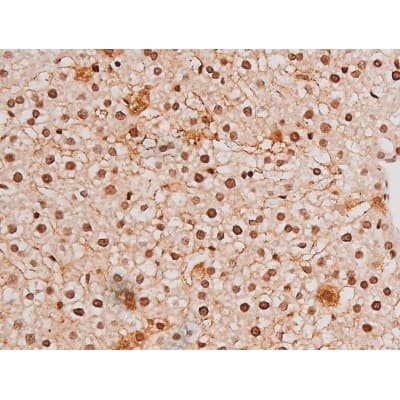 STAT3 Antibody (phospho-Tyr705)