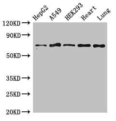 Polyclonal Rabbit anti-Human EIF2AK1 Antibody (IHC, IF, WB)