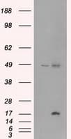 CTAG1B / NY-ESO-1 Antibody (clone OTI3F10)