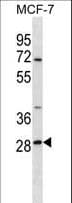 SRPRB Antibody (aa207-236)