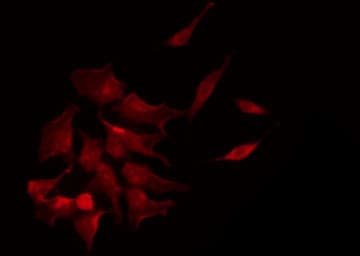 ERBB2 / HER2 Antibody