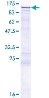 Human MATR3 / Matrin 3 Protein (Recombinant GST)